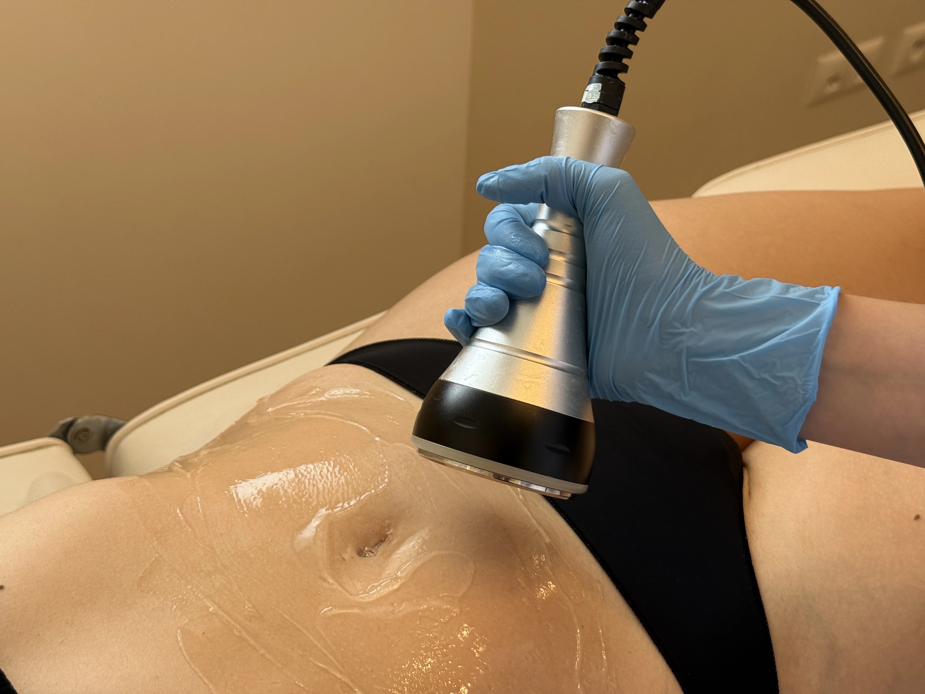 Zabieg liposukcji kawitacyjnej w salonie Epil Care